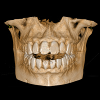 TC Cone Beam CBCT