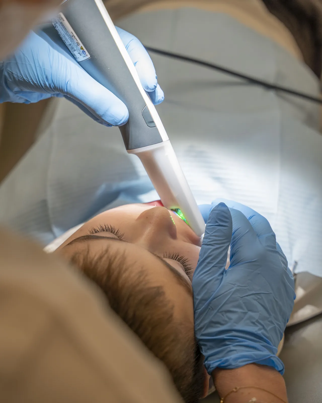 Rilevazione dell'impronta con scanner intraorale