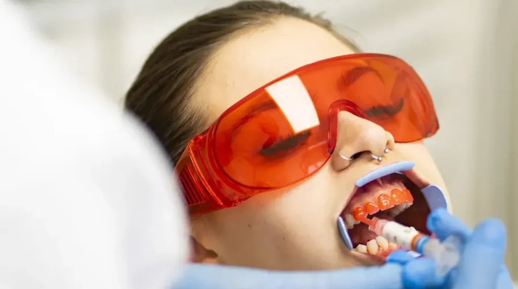 Paziente durante lo sbiancamento dentale